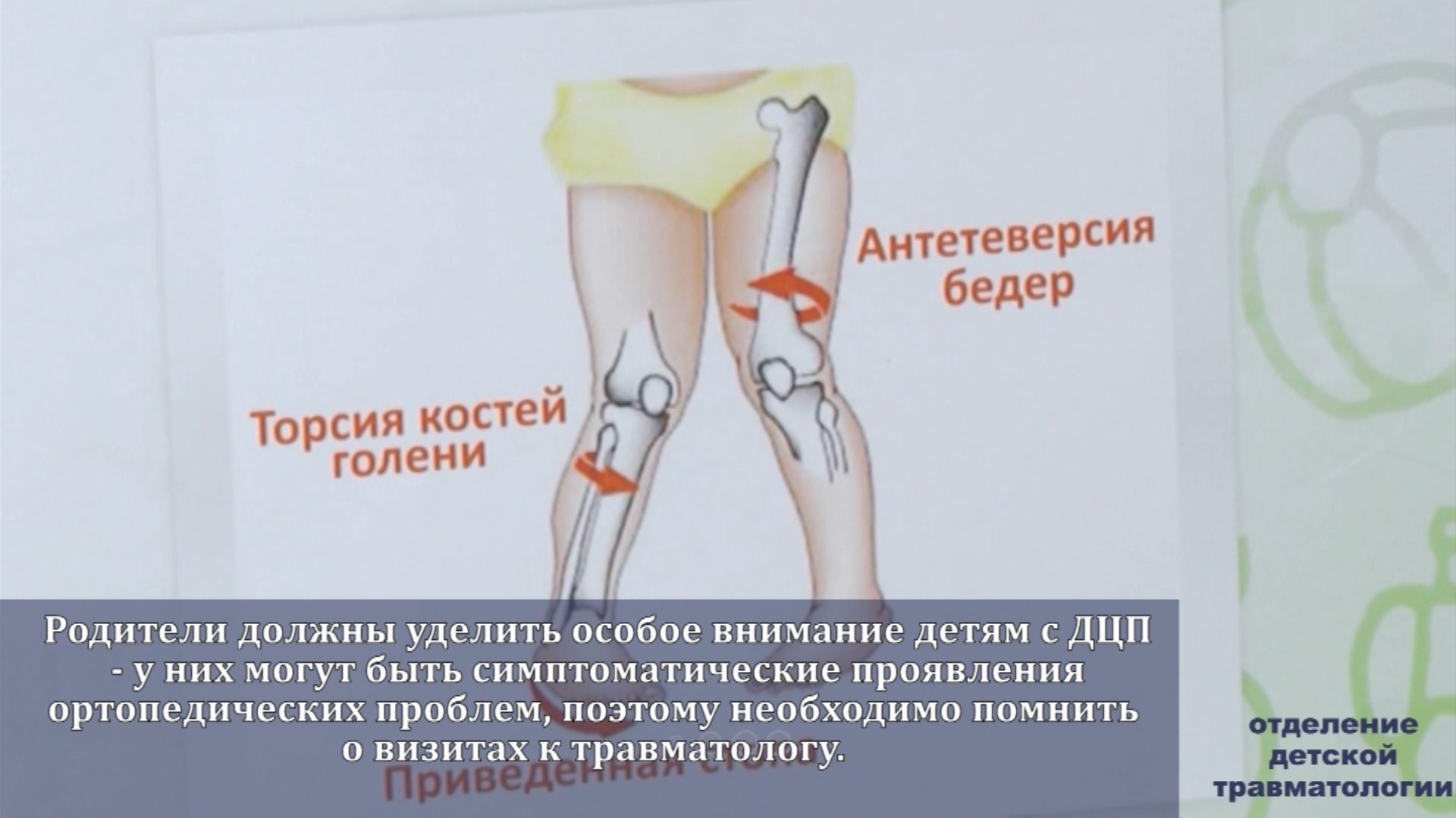 Харьковскаягородскаяклиническаямногопрофильнаябольница№,Детскоетравматологическоеотделение,дцп,Антирабическийкабинет,Круглосуточныйтравматологическийпункт,УЗИ,операциидети,Харьков,Харкьвновости,новостиХарьков,ВістіНьюс