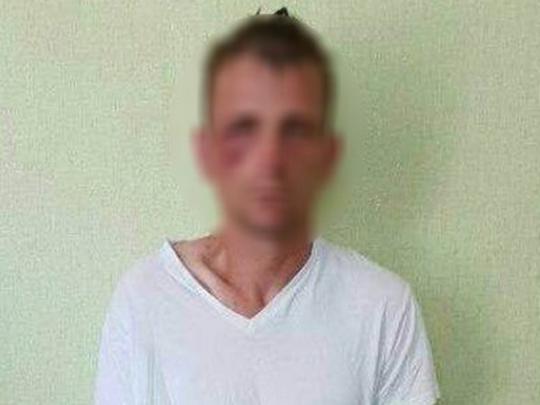 У Кривому Розі затримали маніяка на живця, що напав на шістьох жінок