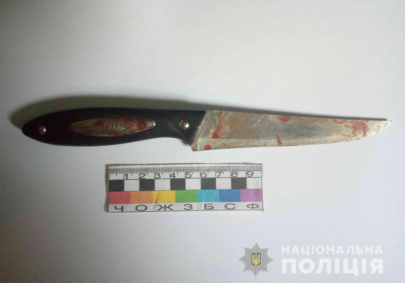 Не поділили комп'ютер: У Нікополі брат наніс 18 ножових поранень молодшій сестрі